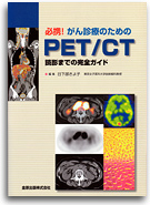 必携！がん診療のためのPET/CT読影までの完全ガイド